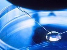 不孕不育如何检查 不孕不育21步教您如何排查？